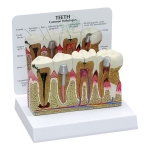 Teeth Model With Description Plate