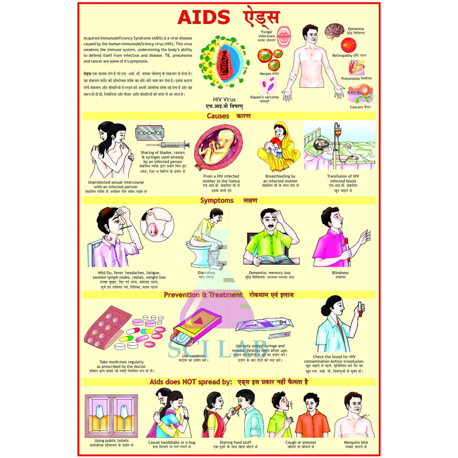 AIDS Disease