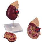 Human Kidney On Stand Model